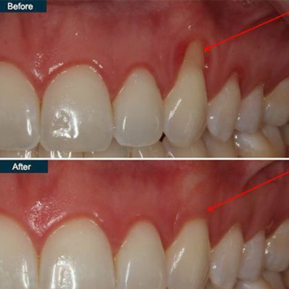 Aurevia's Dental Armor