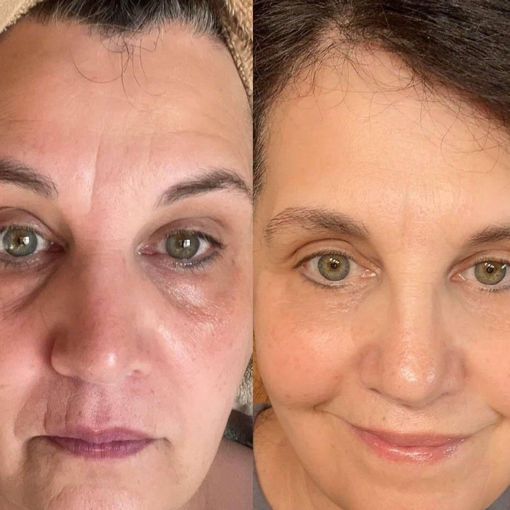 Aurevia Calcium Lift Eye Balm™