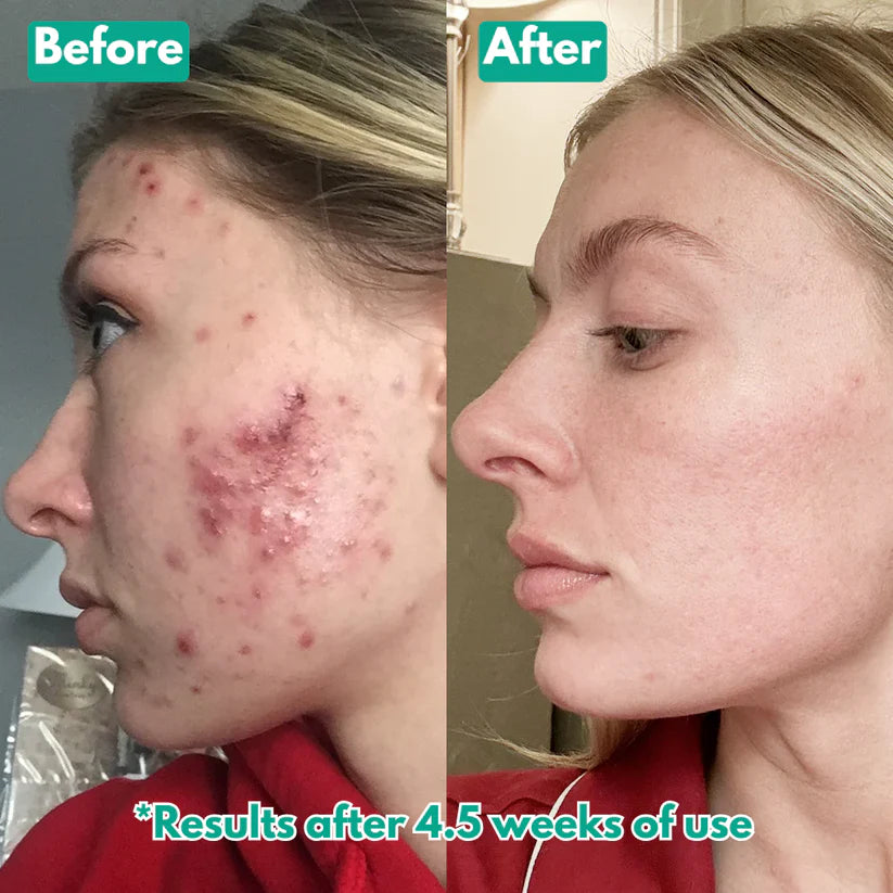 Aurevia™ Microneedling Serum