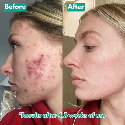 Aurevia™ Microneedling Serum