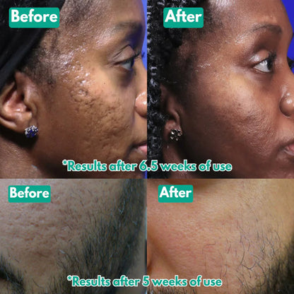 Aurevia™ Microneedling Serum