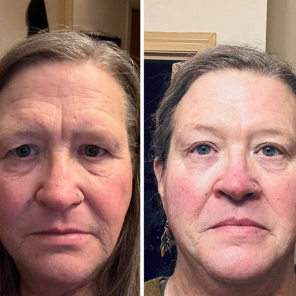 Aurevia Calcium Lift Eye Balm™