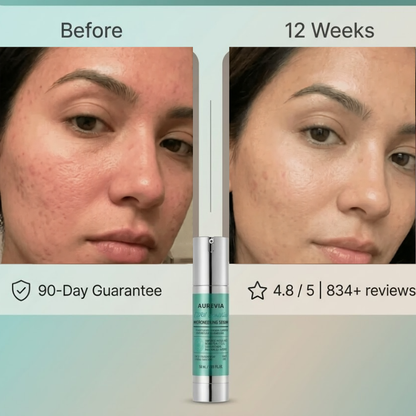 Aurevia™ Microneedling Serum