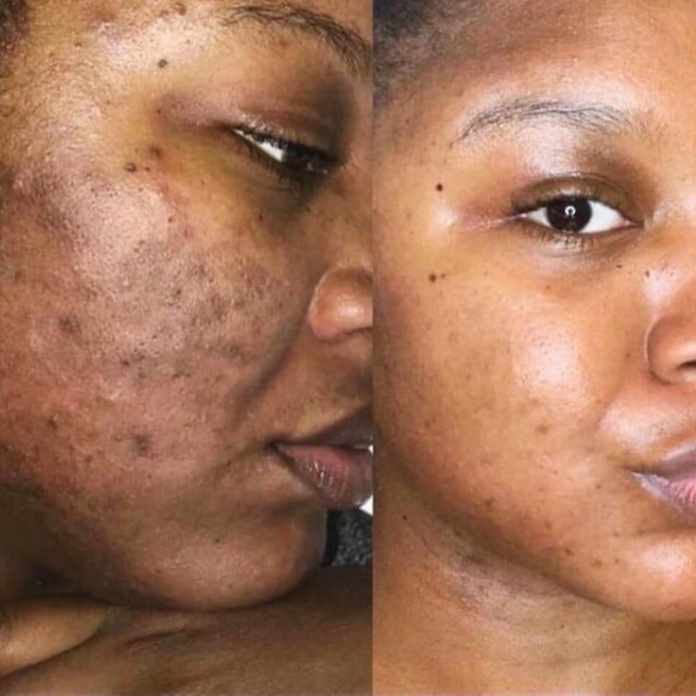 Aurevia™ Pigment Reset Cream